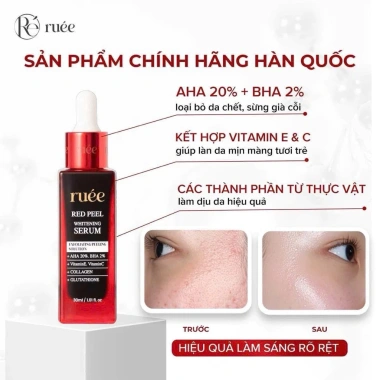 Combo ngày đêm Rúee 50ml hỗ trợ nám, làm trắng da, da căng bóng - Giá chỉ 255k