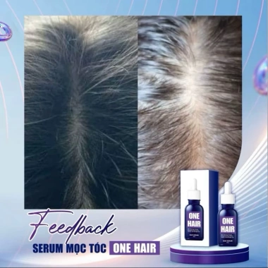 Combo Serum Mọc Tóc + Xịt Dưỡng Nang Tóc One Hair – Hỗ Trợ Tóc Hói, Giá 139.000₫