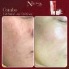 Combo tái sinh Dưỡng da Trắng sáng Tăng Collagen Ngăn lão NGLOW29 2.304tr 6