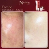 Combo tái sinh Dưỡng da Trắng sáng Tăng Collagen Ngăn lão NGLOW29 2.304tr 7