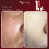 Combo tái sinh Dưỡng da Trắng sáng Tăng Collagen Ngăn lão NGLOW29 2.304tr 9