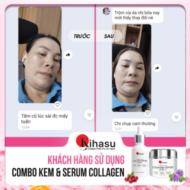 Combo Trắng Da Kihasu 6in1 Serum - Kem Dưỡng - Sáng Da, Dưỡng Ẩm, Ngăn Lão, Giảm Thâm - 559.000₫ 2