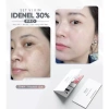 Combo vi kim sinh học 30% chăm sóc da mặt - Dưỡng sâu, giảm mụn, giá 380.000₫ 3