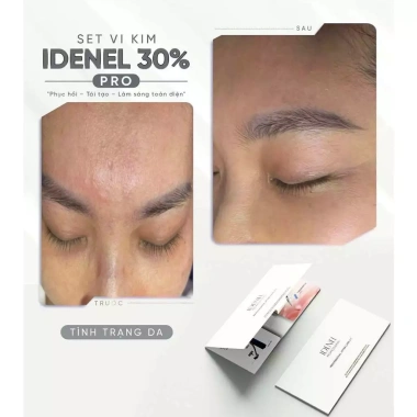 Combo vi kim sinh học 30% chăm sóc da mặt - Dưỡng sâu, giảm mụn, giá 380.000₫