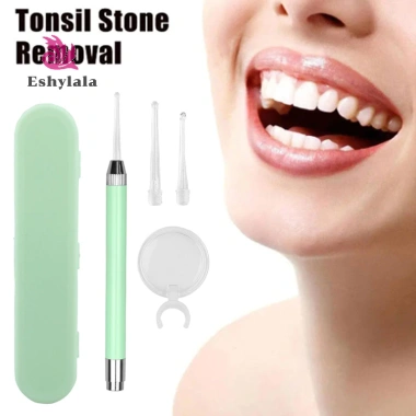 Công cụ loại bỏ đá Tonsil, tẩy sáp tai - Sức khỏe miệng tốt, giảm 20%