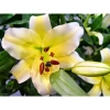 Củ Hoa Ly Cao Hà Lan - Hoa Thơm Nhiều Màu Đẹp, Giá Chỉ 12.000₫ - Shop Huyền My 4