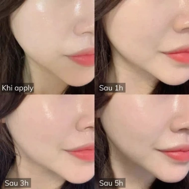 Cushion BB Cream Renoderm Day Long Mẫu Mới - Dưỡng ẩm 24h, Che khuyết điểm, Giá chỉ 632.000 VND
