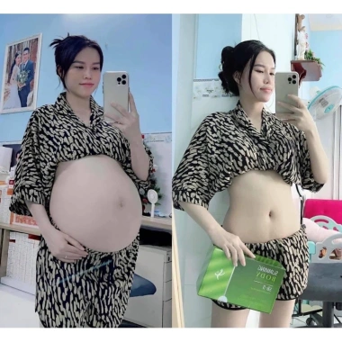 Đai Quấn Ủ Nóng Thải Mỡ Slimming Body Cơ Bản - Giảm Bụng Đùi Tay Chân, Kèm Gen Dán, Giá Ưu Đãi 179.999