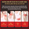 Dán Ngải Cứu 250 miếng - Giảm Đau Cổ Vai Gáy, 5 Túi, Cao Dán, Giá Ưu Đãi 36.990đ 2