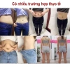 Dán Tan Mỡ Ngải Giảm Mỡ Bụng, Cánh Tay, Bắp Đùi - Giảm Mỡ Nhanh, An Toàn 79.000đ 2