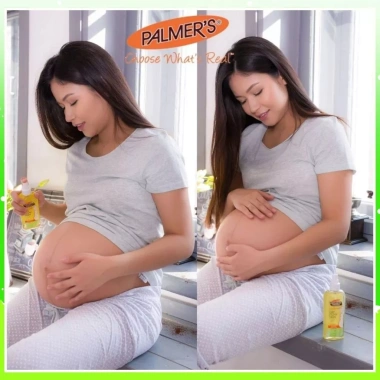 Dầu dưỡng ẩm Palmer's 150ml Cocoa Butter Vitamin E, làm dịu da khô ngứa, 367.067 VND 8 Dầu dưỡng ẩm Palmer's 150ml Cocoa Butter Vitamin E, làm dịu da khô ngứa, 367.067 VND 8