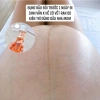 Dầu Dưỡng Da Body Bl0 Oil Giảm Rạn Da 200ml Fullbox - Siêu Giảm Giá 1.068.000 VND 3