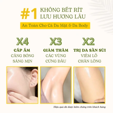 Dầu dưỡng sáng da giảm thâm Ấn Độ – Căng bóng, ẩm mượt, đều màu, hương hoa hồng, 179.000₫