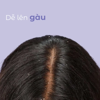 Dầu Gội BC Anti Dandruff 250ml - Chống Gàu Hiệu Quả, Giá Ưu Đãi 398.000₫ 4 Dầu Gội BC Anti Dandruff 250ml - Chống Gàu Hiệu Quả, Giá Ưu Đãi 398.000₫ 4