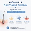 Dầu Gội CANOVA RIVESCAL DS - Sạch Gàu, Trị Nấm Da Đầu, Giảm Ngứa và Rụng Tóc, Giá 500k (Giảm 140k) 4