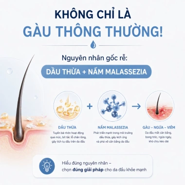 Dầu Gội CANOVA RIVESCAL DS - Sạch Gàu, Trị Nấm Da Đầu, Giảm Ngứa và Rụng Tóc, Giá 500k (Giảm 140k)