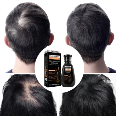 Dầu gội chống gàu thảo dược - Kích thích mọc tóc, ngừa nấm ngứa, bảo vệ nang tóc - 62k 8