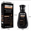 Dầu gội chống gàu thảo dược - Kích thích mọc tóc, ngừa nấm ngứa, bảo vệ nang tóc - 62k 9
