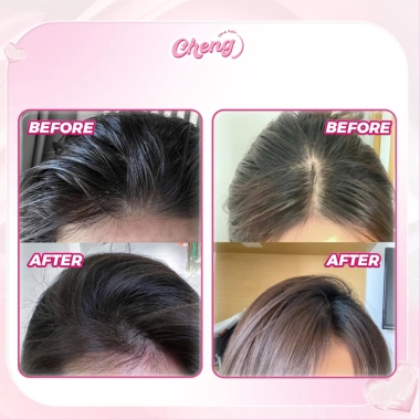 Dầu Gội Khô Gel Kiềm Dầu Chenglovehair - Tóc Bồng Bềnh, Giảm Giá 78.000₫