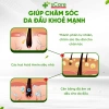 Dầu Gội sCare Sạch Gàu - Giảm Gàu, Bong Tróc, Ngứa, Nấm Da Đầu, Dược Liệu 219k 4