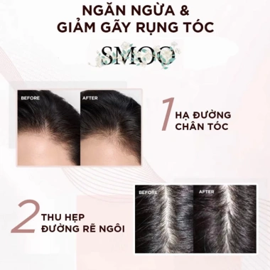 Dầu gội SMOO cho tóc tươi - Ngừa khô rụng, mượt không thắt nút, giá 169.000 VND 7
