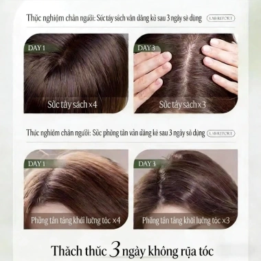 Dầu gội SMOO cho tóc tươi - Ngừa khô rụng, mượt không thắt nút, giá 169.000 VND 9