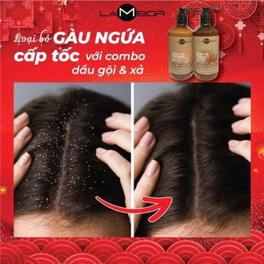 Dầu Gội Xả Keratin Lambor 1.000ml*2 - Sạch Gàu, Chống Gãy Rụng, Phục Hồi Nang Tóc 8 Dầu Gội Xả Keratin Lambor 1.000ml*2 - Sạch Gàu, Chống Gãy Rụng, Phục Hồi Nang Tóc 8