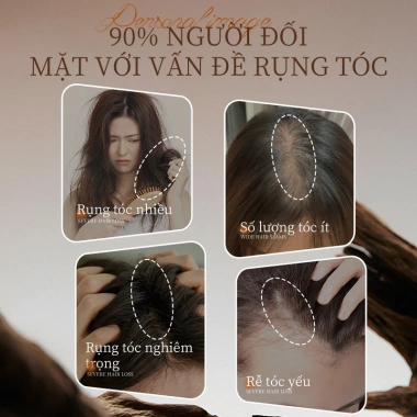 Dầu gội ZXT ngăn rụng tóc, chống gàu, kiểm soát dầu, tóc bồng bềnh - Giảm còn 229.000₫