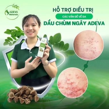 Dầu hạt chùm ngây ép lạnh Moringa Oil Adeva Noni 100ml - Dưỡng ẩm, giảm ngứa, vảy nến, viêm da - 175.420 VND 6