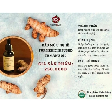 Dầu Mù U Ngâm Nghệ Hữu Cơ Karose 30ml - Dưỡng da, giảm mụn, giảm giá 275k