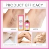 Dầu Tẩy Tóc Kín Chất Ức Chế 60ml Nguyên chất – Tái tạo tóc, thích hợp cho cánh tay, bikini, chân, phòng gym, du lịch 6