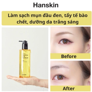 Dầu Tẩy Trang Hanskin Cleansing Oil 300ml - Sạch Sâu, Giảm Mụn Đầu Đen, 600k 8 Dầu Tẩy Trang Hanskin Cleansing Oil 300ml - Sạch Sâu, Giảm Mụn Đầu Đen, 600k 8
