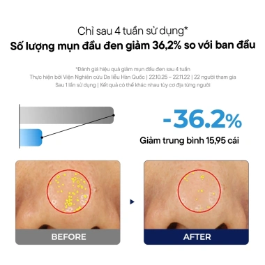 Dầu tẩy trang ONE DAY'S YOU SSG SSAC Deep Cleansing Oil 200ml - Sạch sâu, giảm mụn đầu đen, giá ưu đãi 383.900₫ 2