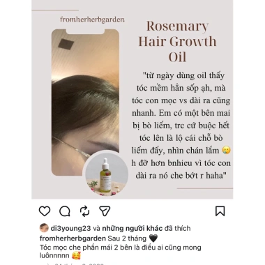 Dầu ủ tóc Xomnhala Rosemary Scalp Hair Growth Oil thiên nhiên, giảm giá 119.000đ