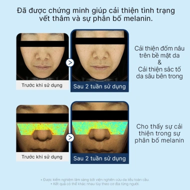 Dearglam Combo Serum Traxenamic 3% Dưỡng Trắng, Mờ Thâm Nám & Tàn Nhang - 966.900₫ 2