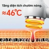 Dụng cụ hút mụn đầu đen gói nóng bong bóng - Làm sạch lỗ chân lông, chỉ 321.334 VND 2