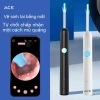 Dụng cụ lấy ráy tai không dây ACK Visual – Siêu rõ, làm sạch phát sán, giảm giá 23% 6