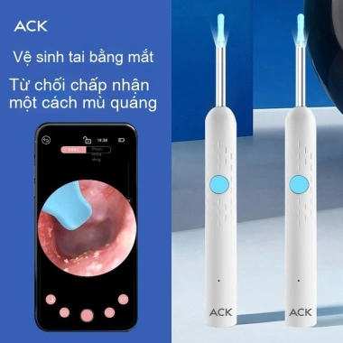 Dụng cụ lấy ráy tai không dây ACK Visual – Siêu rõ, làm sạch phát sán, giảm giá 23% 7
