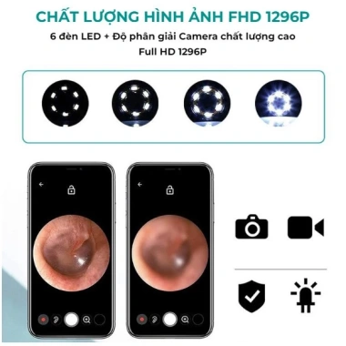 Dụng cụ lấy ráy tai nội soi camera NE3 không dây, điều khiển app, mọi điện thoại – chỉ 39.000₫ 6 Dụng cụ lấy ráy tai nội soi camera NE3 không dây, điều khiển app, mọi điện thoại – chỉ 39.000₫ 6