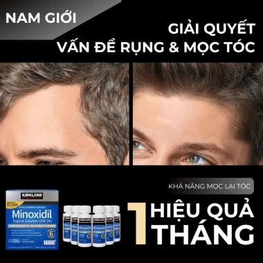 Dung Dịch Mọc Tóc Râu Mỹ 60ml Chính Hãng - Tăng Tóc Dày, Râu Nhanh, Giảm 20% 2