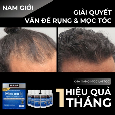 Dung Dịch Mọc Tóc Râu Mỹ 60ml Chính Hãng - Tăng Tóc Dày, Râu Nhanh, Giảm 20% 3
