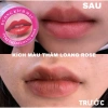 Dưỡng ẩm & Kích màu thâm loang Rose - Giảm thâm nhanh, da sáng tươi, Giá ưu đãi 33.600₫ 3