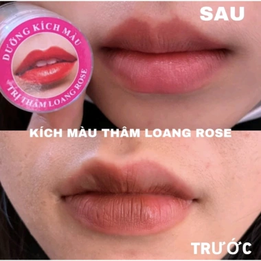 Dưỡng ẩm & Kích màu thâm loang Rose - Giảm thâm nhanh, da sáng tươi, Giá ưu đãi 33.600₫