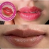 Dưỡng ẩm & Kích màu thâm loang Rose - Giảm thâm nhanh, da sáng tươi, Giá ưu đãi 33.600₫ 4