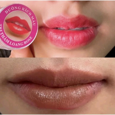Dưỡng ẩm & Kích màu thâm loang Rose - Giảm thâm nhanh, da sáng tươi, Giá ưu đãi 33.600₫