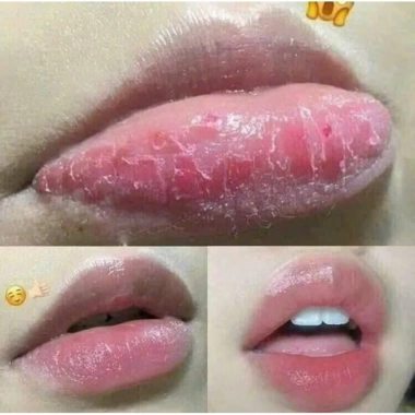 Dưỡng Hồng Môi Collagen Lựu Đỏ LIPSHE Beauty 5g Chính Hãng – Giá 52.800 VNĐ, Dưỡng ẩm & Tăng Căng Bóng 6