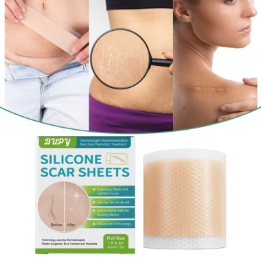 EHES Băng sẹo silicon 1 cuộn - Phai màu không đau, phục hồi da nhanh, 143.956₫