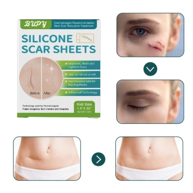 EHES Băng sẹo silicon 1 cuộn - Phai màu không đau, phục hồi da nhanh, 143.956₫