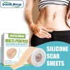 EHES Miếng dán sẹo silicon - Loại bỏ và sửa chữa vết bỏng, chấn thương, giá ưu đãi 149.367 VND