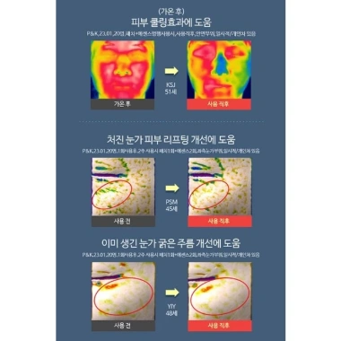 FRANZ Sunshield Patch 5 – Miếng dán UV Block, chơi thể thao ngoài trời, 209.000₫ 8